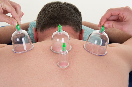 Dry Cupping Therapy